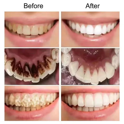 Bright Smile Saver Mousse Toothpaste