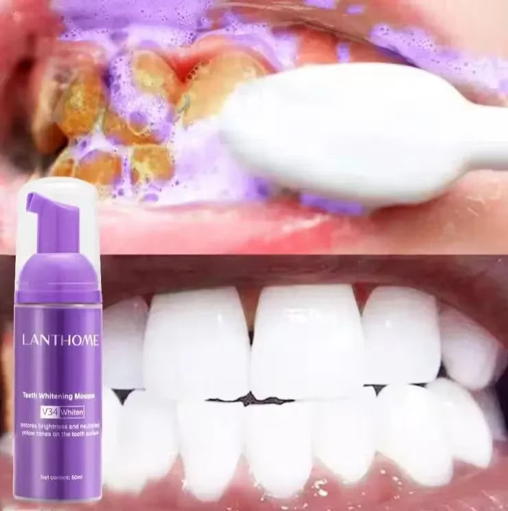 Bright Smile Saver Mousse Toothpaste