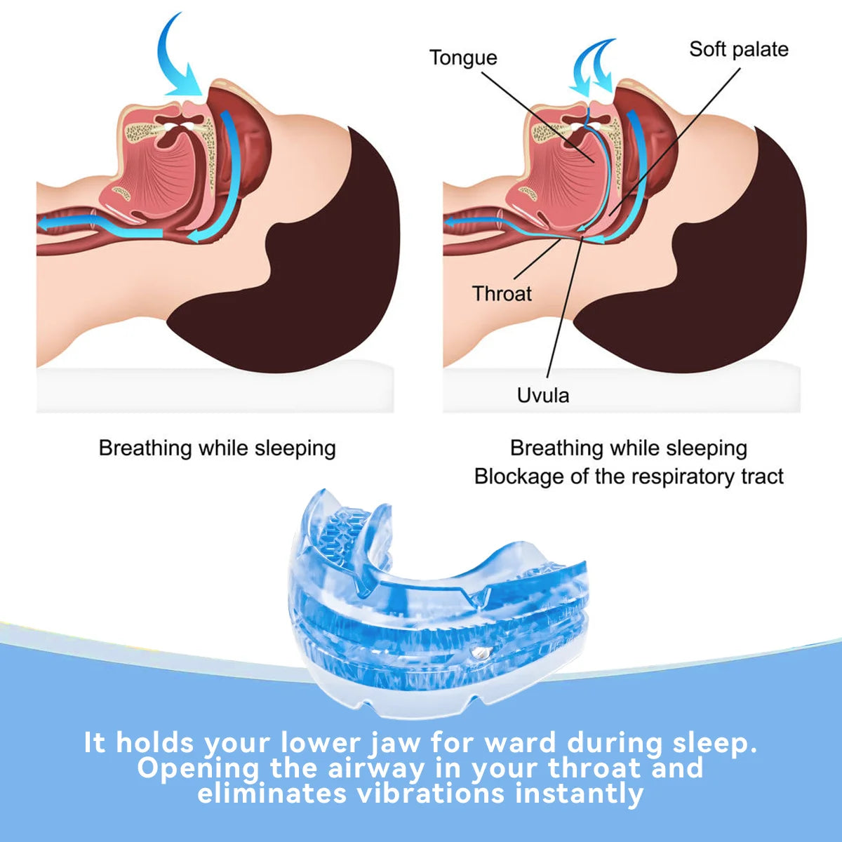 Night Anti-Snoring Mouth Guard